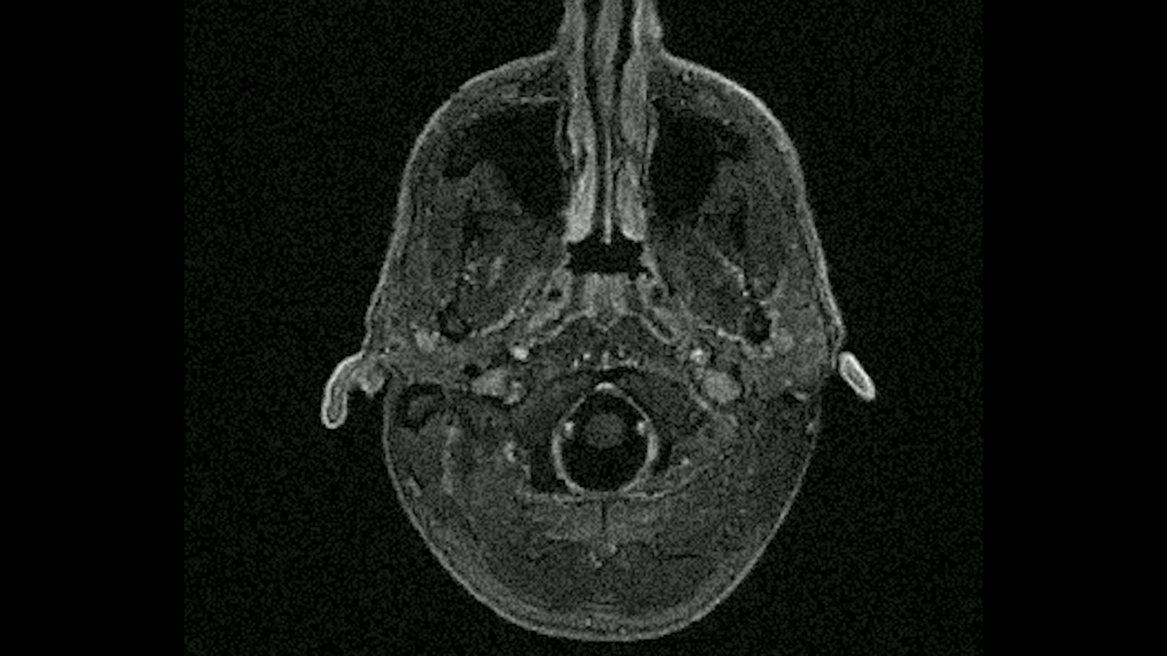 Zurich - The Lost Sense Experience